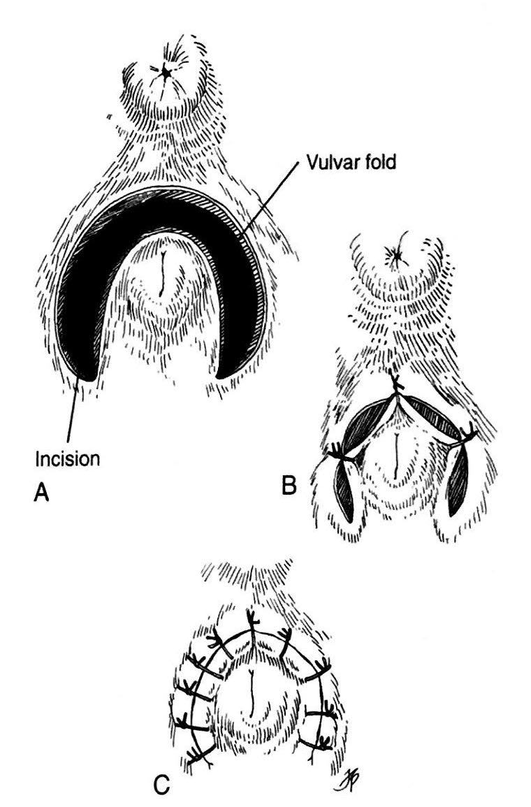 Episioplastia para dermatitis perivulvular en perros Veterinarian Center