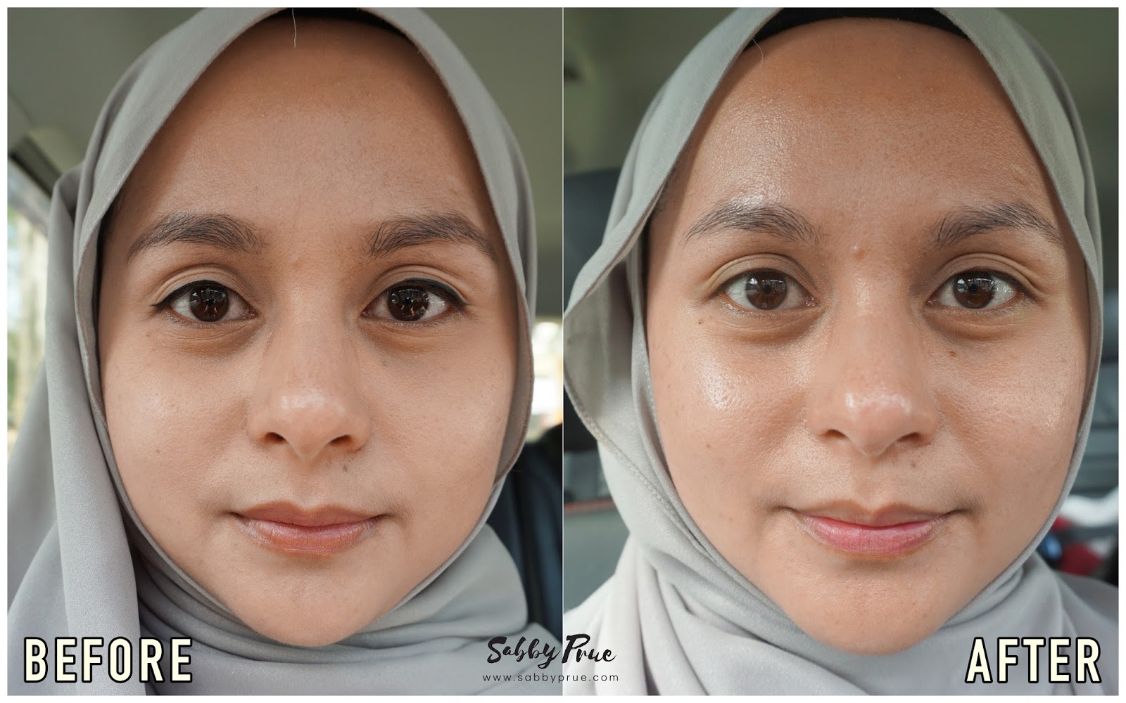 silkpeel dermalinfusion