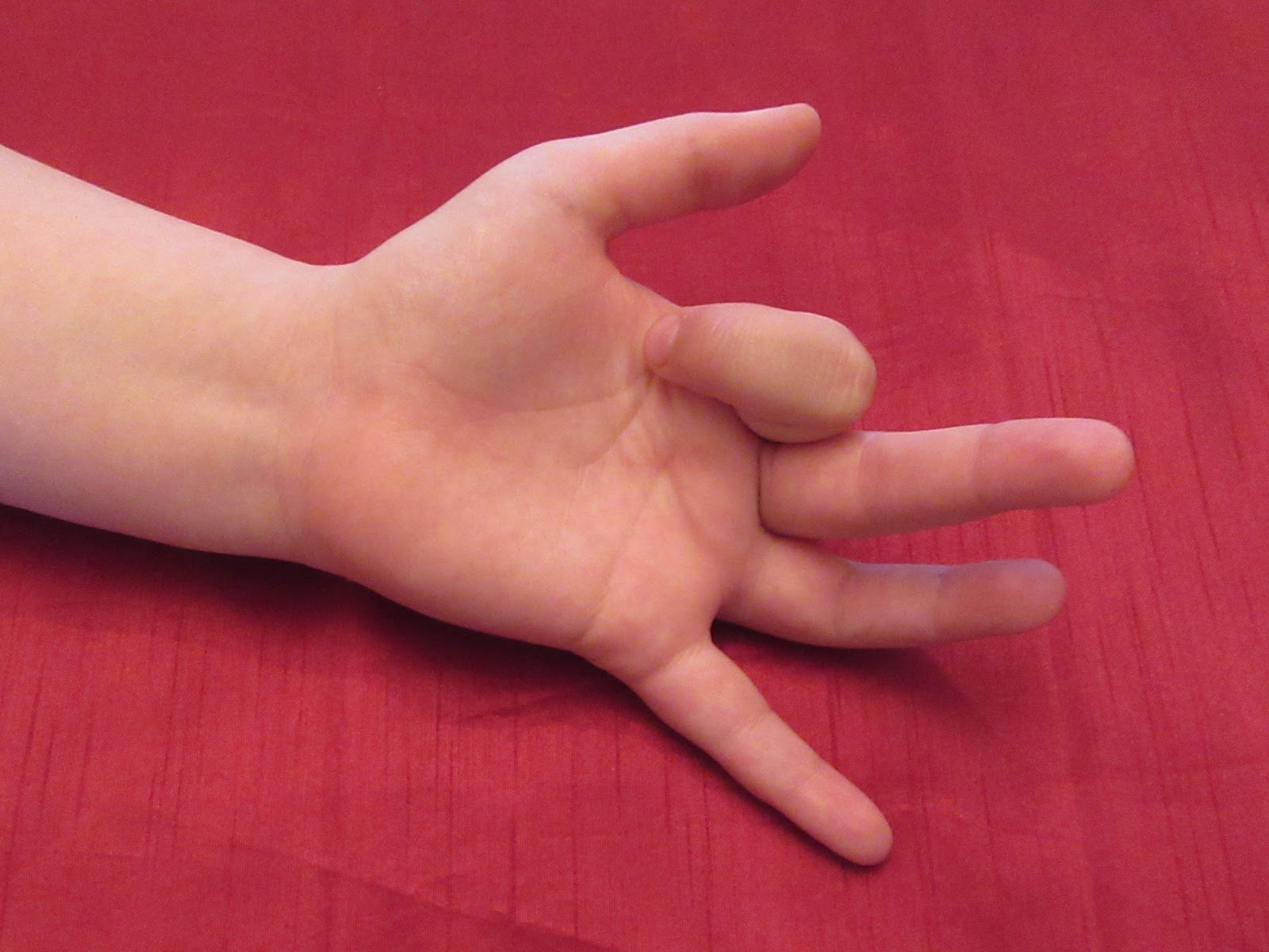 Paediatrics For Primary Care and Anyone Else Minor Injuries Three 