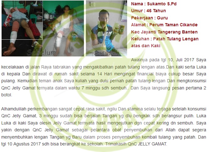 Hasil gambar untuk testimoni QnC patah tulang