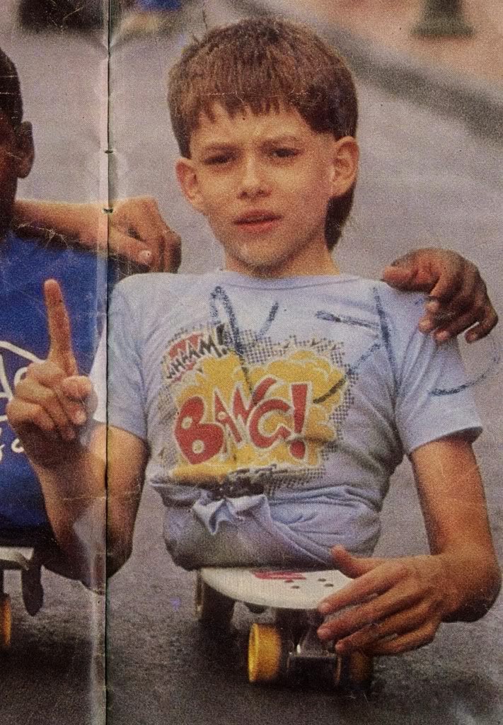 половина человека как живут