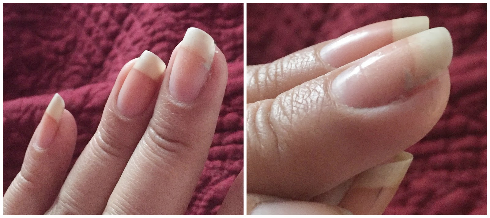 [Innisfree] First Aid Kit for nails Korean Beauty Dream