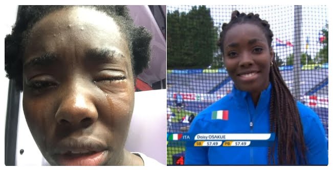 Aggressione Daisy Osakue: "è razzismo, io tifo Juventus".