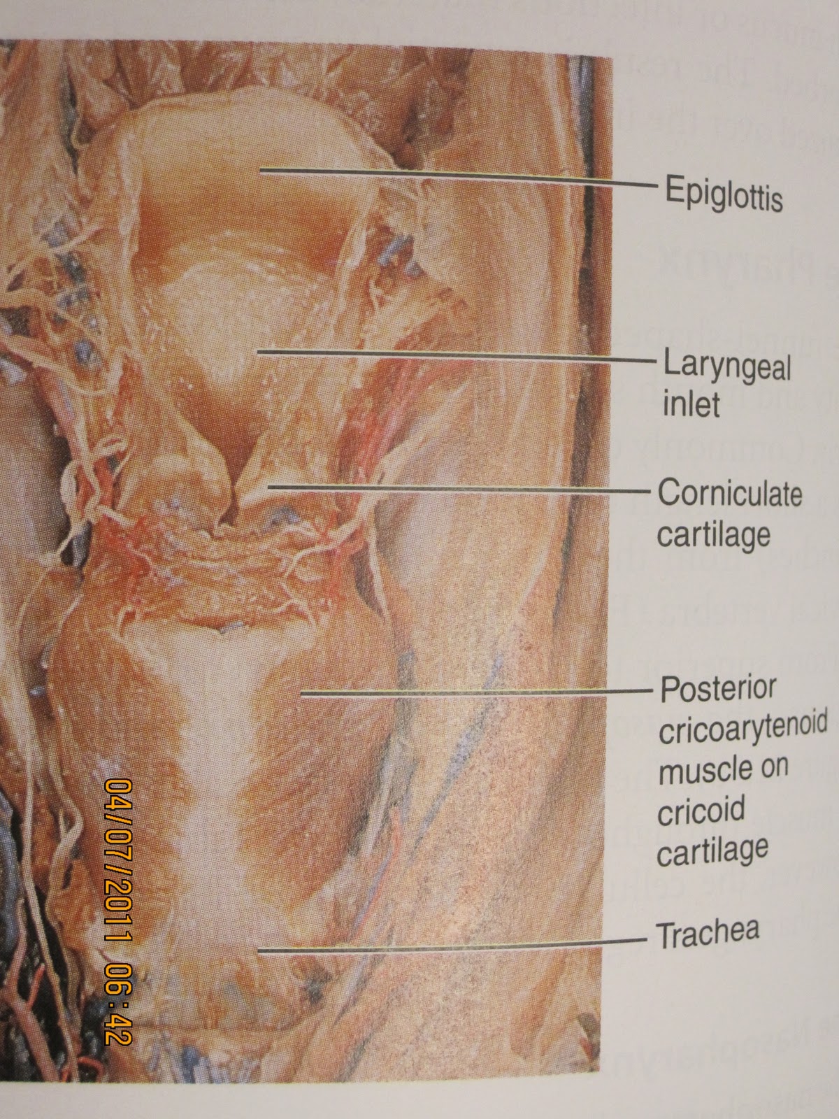 Anatomy and Physiology 2 Eportfolio: Objective 43 & 44: Respiratory ...