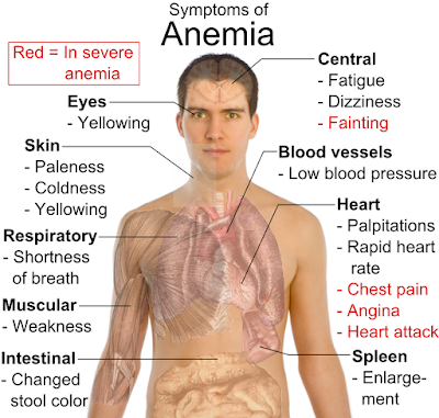 simptom anemia