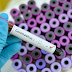 How To Boost Your Immune System Against Coronavirus - Expert Reveals