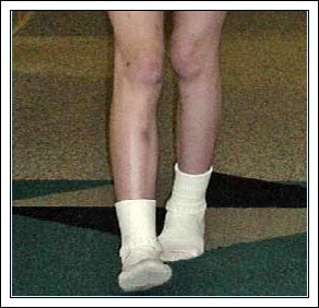 Cocuklarda Ice Basma Anne Kaleminden