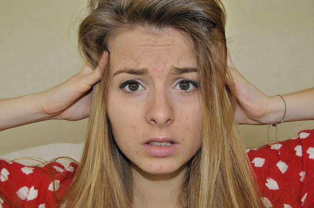 Comment remplacer androcur