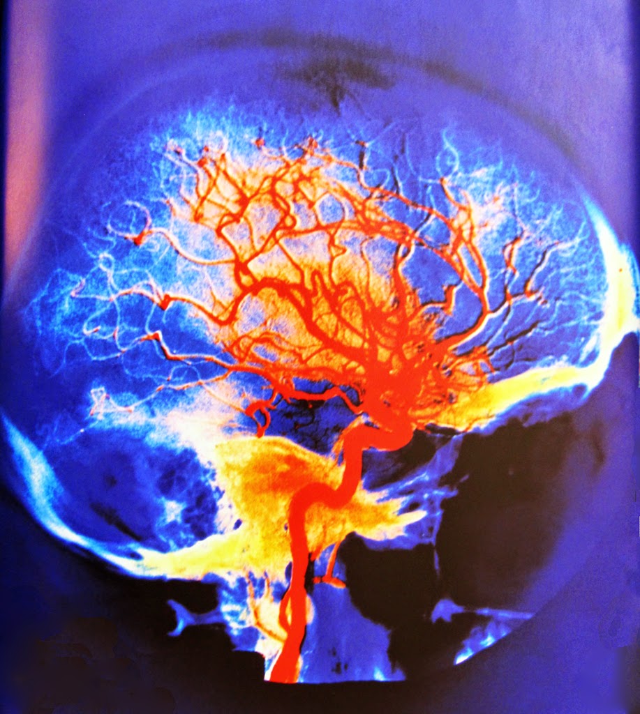 Discovering Something New ongoing learning Oxygen supply to human brain