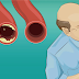 Estos 10 alimentos limpian tus arterias naturalmente y te protegen de ataques al corazón. ¡Vivirás más tiempo!