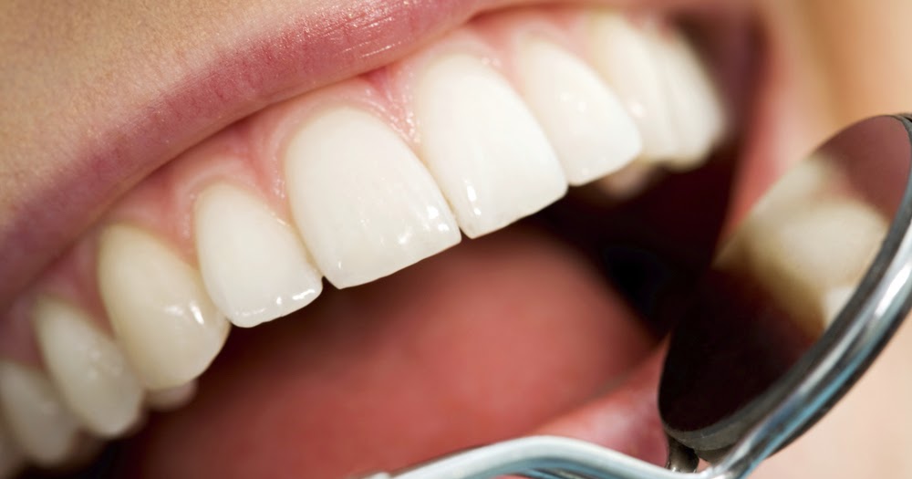 CarillonCityDental How Much Does Teeth Whitening Cost