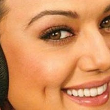 Kecacatan Yang Menawan