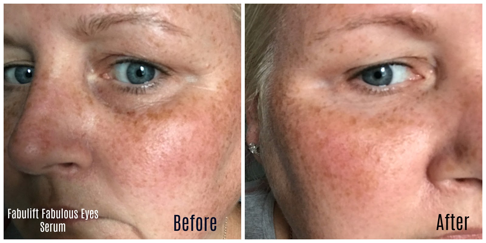 Fabulift Fabulous Eyes Eye Lifting Serum Including Before And After