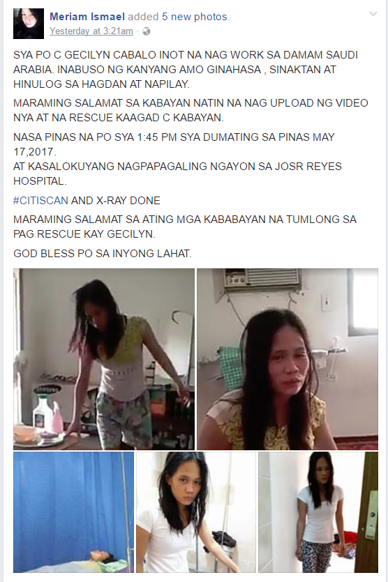 A Filipina who can barely walk allegedly due to the maltreatment and physical abuse of her employer. On a viral video that was uploaded by a certain Paulyn Adan that is making rounds on social media, her roommate recorded her while walking with utmost difficulty. On the said video, the OFW is asking for help because she cannot bear it anymore and she wants to go home.  According to another social media post from a certain Lyka Bilbar, Gecilyn Inot, an OFW from Dammam , Saudi Arabia was raped, beaten, fallen from the staircase that resulted her difficulty in walking. She also said that Inot has not been able to eat for 6 days before the embassy rescued her  at around 1;48 in the afternoon on May 14.  Mocha Uson Blog confirms that the OFW was already rescued by the embassy personnel. According to the message sent by OWWA Administrator Hans Leo Cacdac, they already brought the OFW to the hospital to undergo some tests especially on her bump on the head.     Another social media post confirms that Gecilyn is now in the Philippines and currently recovering at the Jose Reyes Memorial Hospital. The post said that she has already undergone CT Scan and X-ray tests. She arrived  at 1:45PM on May 17.  Cases of maltreatment to the OFWs in Saudi Arabia can be found in the news almost everyday for years thus the call to stop sending HSWs in the Middle East especially in Saudi Arabia and Kuwait has been a constant cry of different OFW groups to prevent more maltreatment like this from happening.