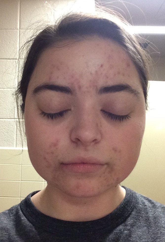 Makeup Artist's Choice Before/After Pics and Testimonials