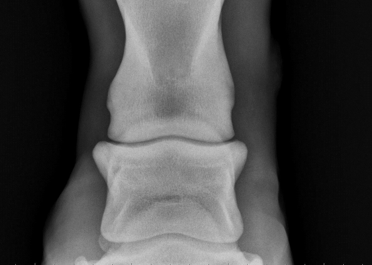 Michael Porter, Equine Veterinarian High Ring Bone!!