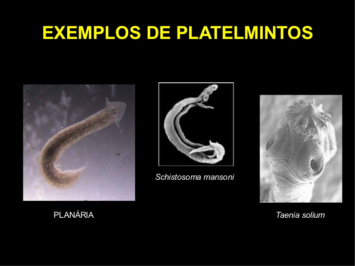 exemple de platyhelminthes filo bag rsak parazitlerinin yumurtalar nas ld r