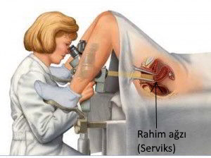 Kanamalı iken jinekolojik muayene yapılabilir mi Kanamalı iken jinekolojik muayene yapılabilir mi