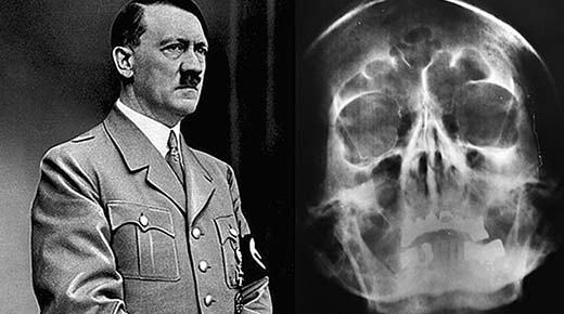 Historiadores admiten finalmente que Hitler no se disparó en la cabeza