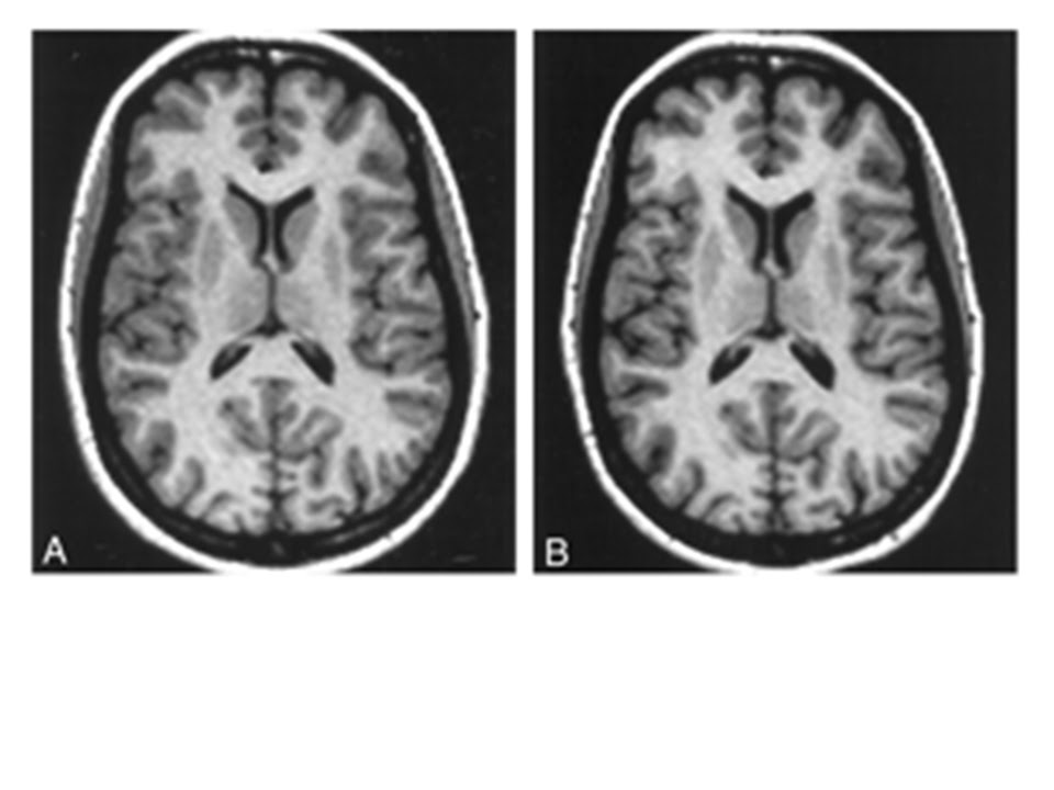 InBabyAttachMode: This is your brain on pregnancy