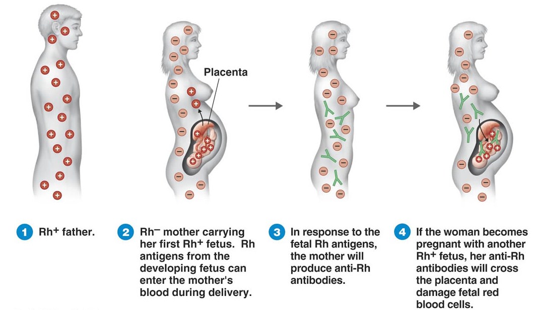 Pregnancy Guide pregnancy-guide