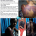 Nigerian woman, Ruth Orji, brutalized by soldiers of the 174 battalion