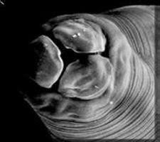 pinwormákkal ismételt fertőzés történt giardiasis hélix