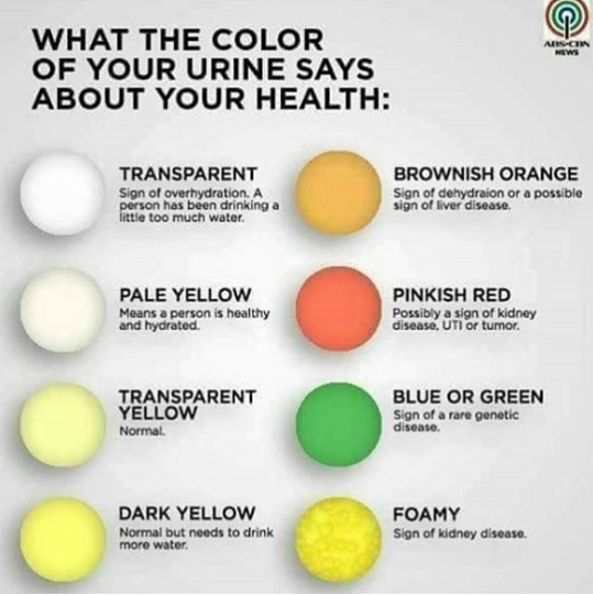 Urine Color Chart And Meaning Hubpages Pin By Mae Detuelo On Nursing