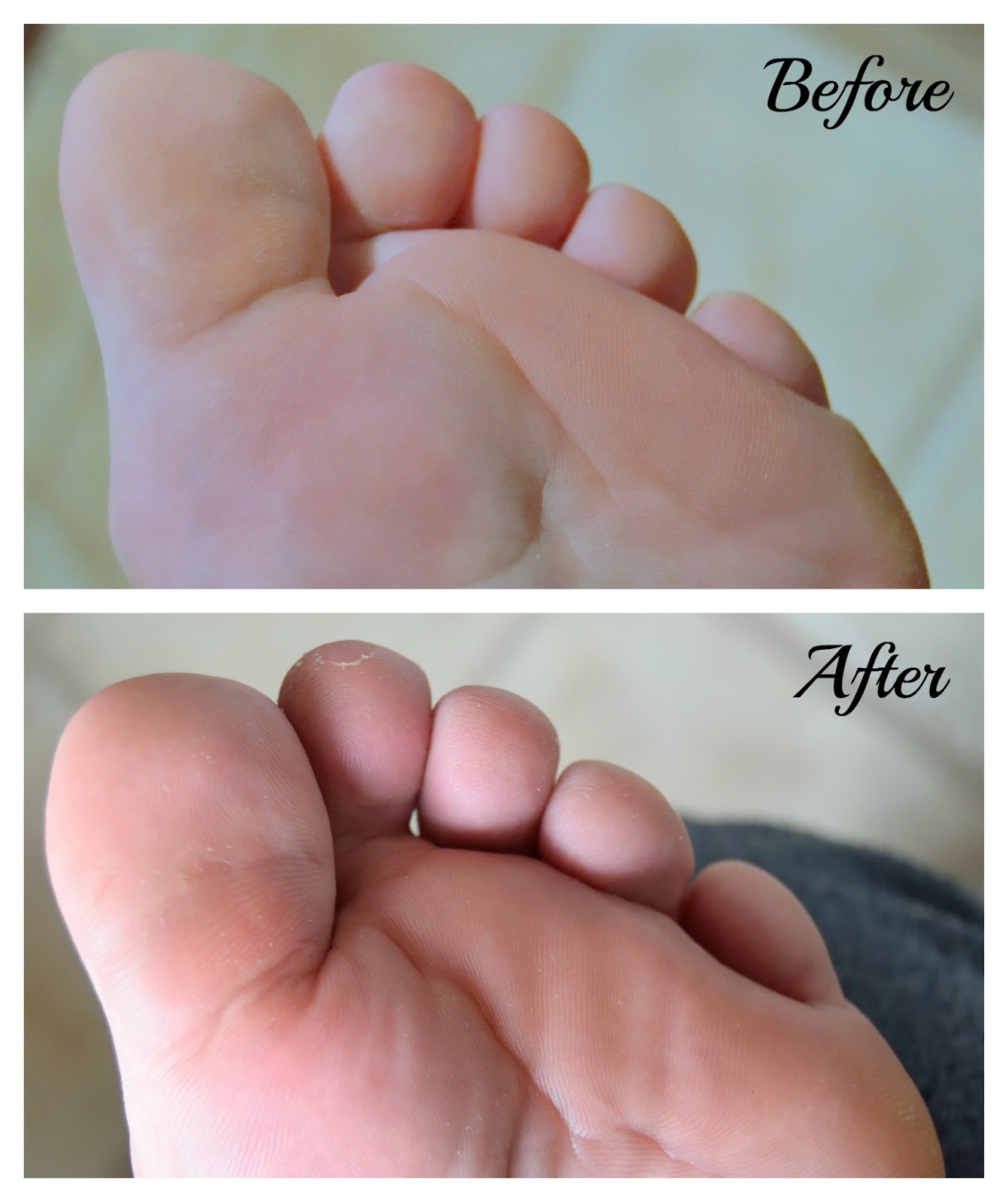 Holika Holika Silky Foot One Shot Peel A picture of Holika Holika Silky Foot One Shot Peel before and after