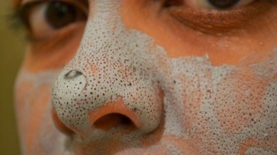 Share your Rid of facial blackheads Remarkable Rid of facial blackheads are mistaken