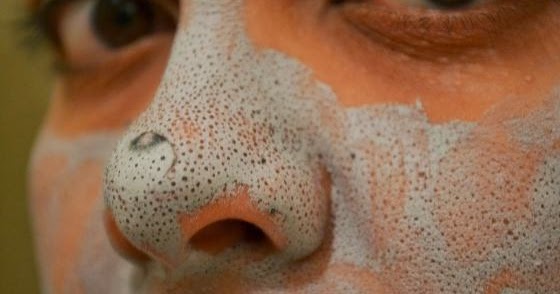 #Beauty : How to Remove Very Deep Blackheads - My Favorite