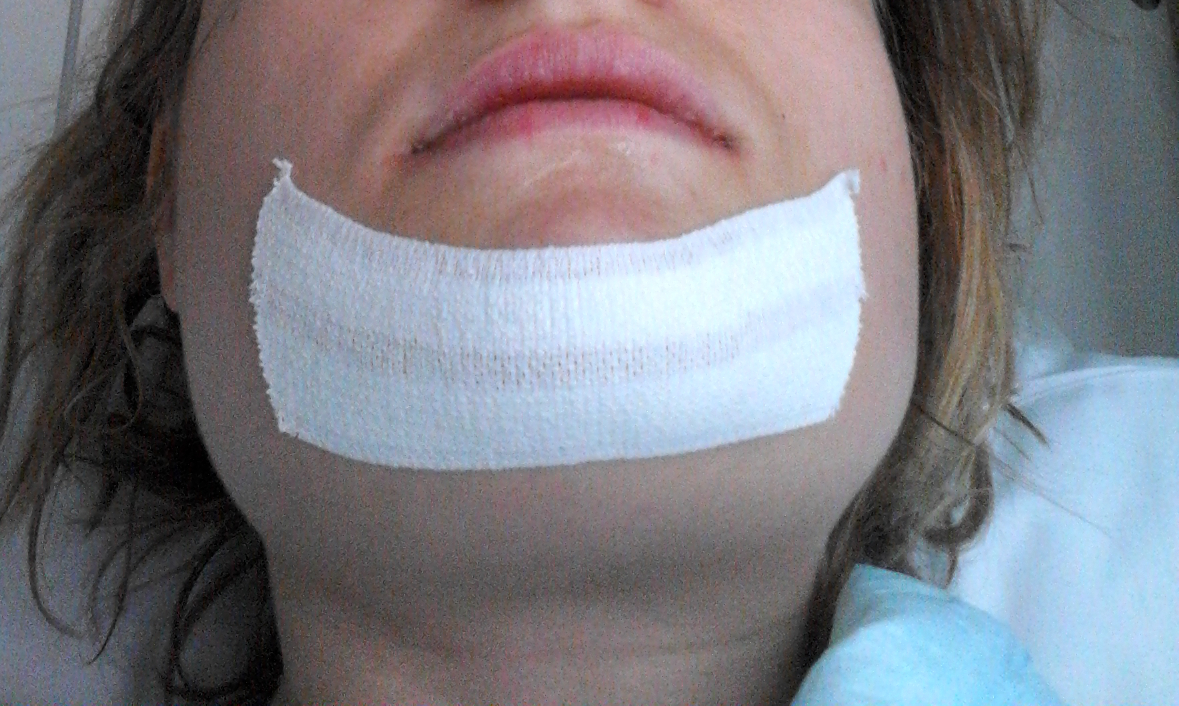 Expérience de Traitement Orthodontique et Chirurgie Maxillo Faciale ...