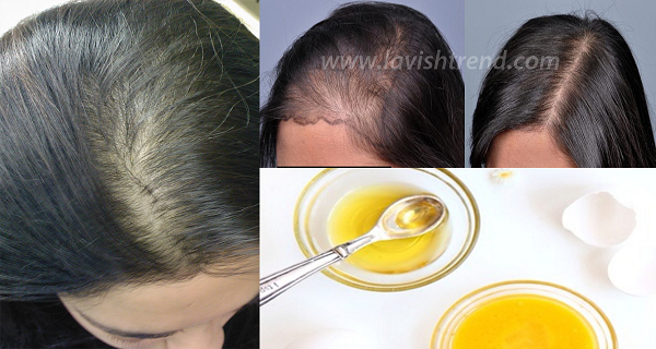 RECETA MÁGICA PARA CRECIMIENTO MÁS RÁPIDO EL CABELLO NATURALMENTE, CADA UNO ES SORPRENDIDO POR LOS RESULTADOS ... RECETA MÁGICA PARA CRECIMIENTO MÁS RÁPIDO EL CABELLO NATURALMENTE, CADA UNO ES SORPRENDIDO POR LOS RESULTADOS ...