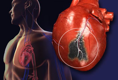 Vitamins That Strengthen Your Heart Vitamins That Strengthen Your Heart
