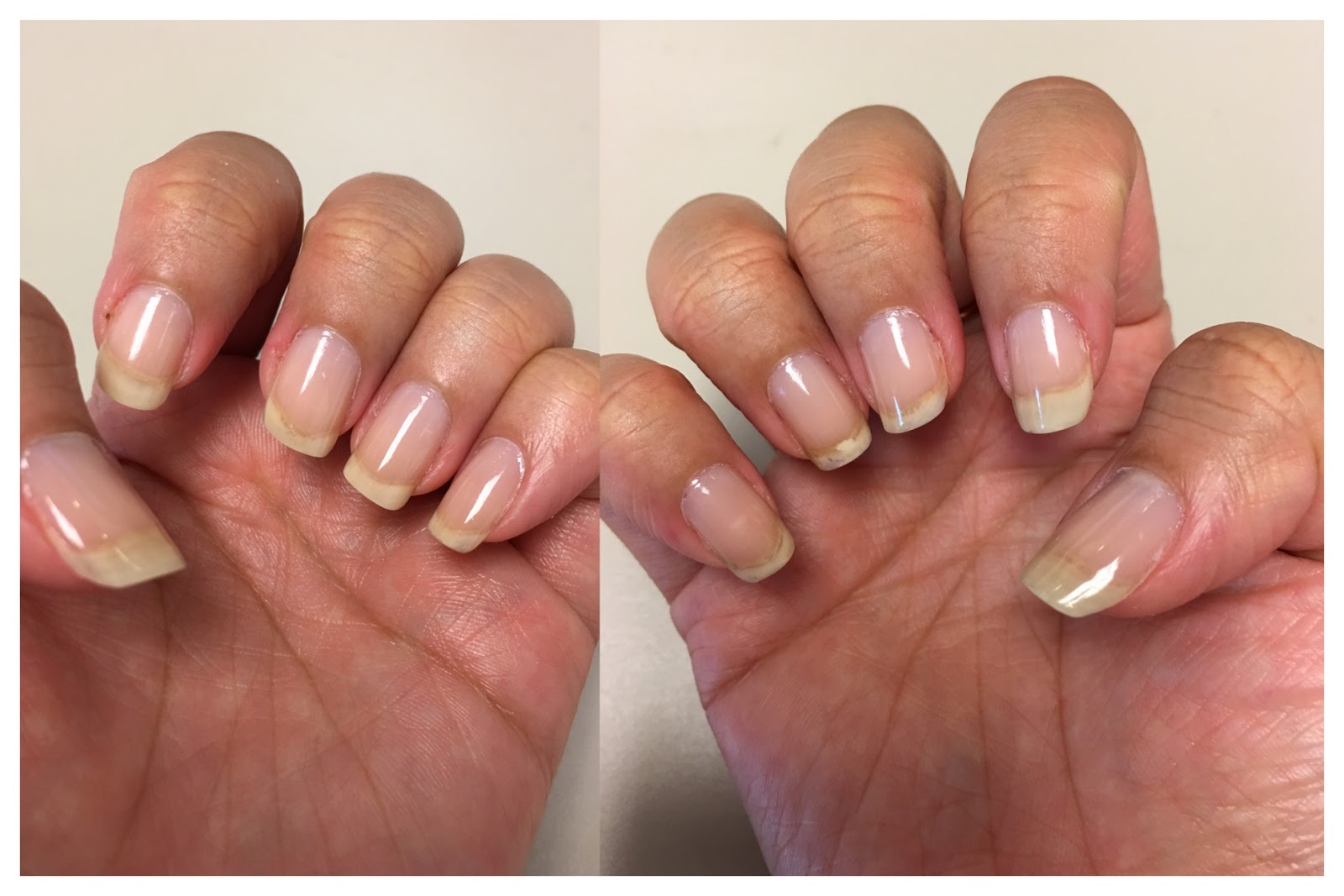 My Nail Growth Journey and the Best Tips and Tricks for Treating Your Nails