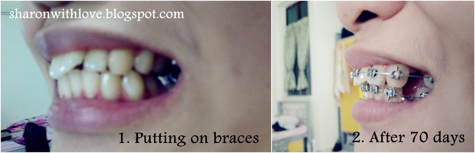 Live. Laugh. Love Before and After 15 Months of Putting