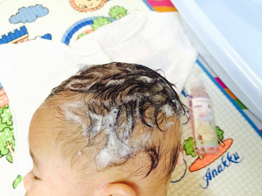 Ubat Eczema Untuk Dewasa 8 Descargar