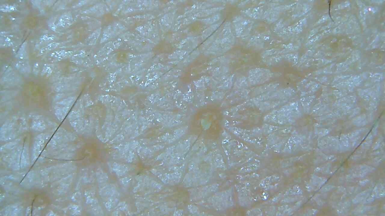 やまだの肌断食1 4週間目の経過