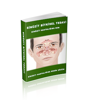 sinuzit dogal tedavi