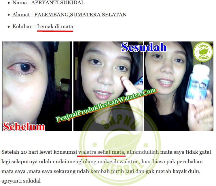 Cara Mengobati Mata Uveitis Secara Alami Dan Cepat ~ TESTIMONI WALATRA SEHAT MATA SOFTGEL Cara Mengobati Mata Uveitis Secara Alami Dan Cepat ~ TESTIMONI WALATRA SEHAT MATA SOFTGEL