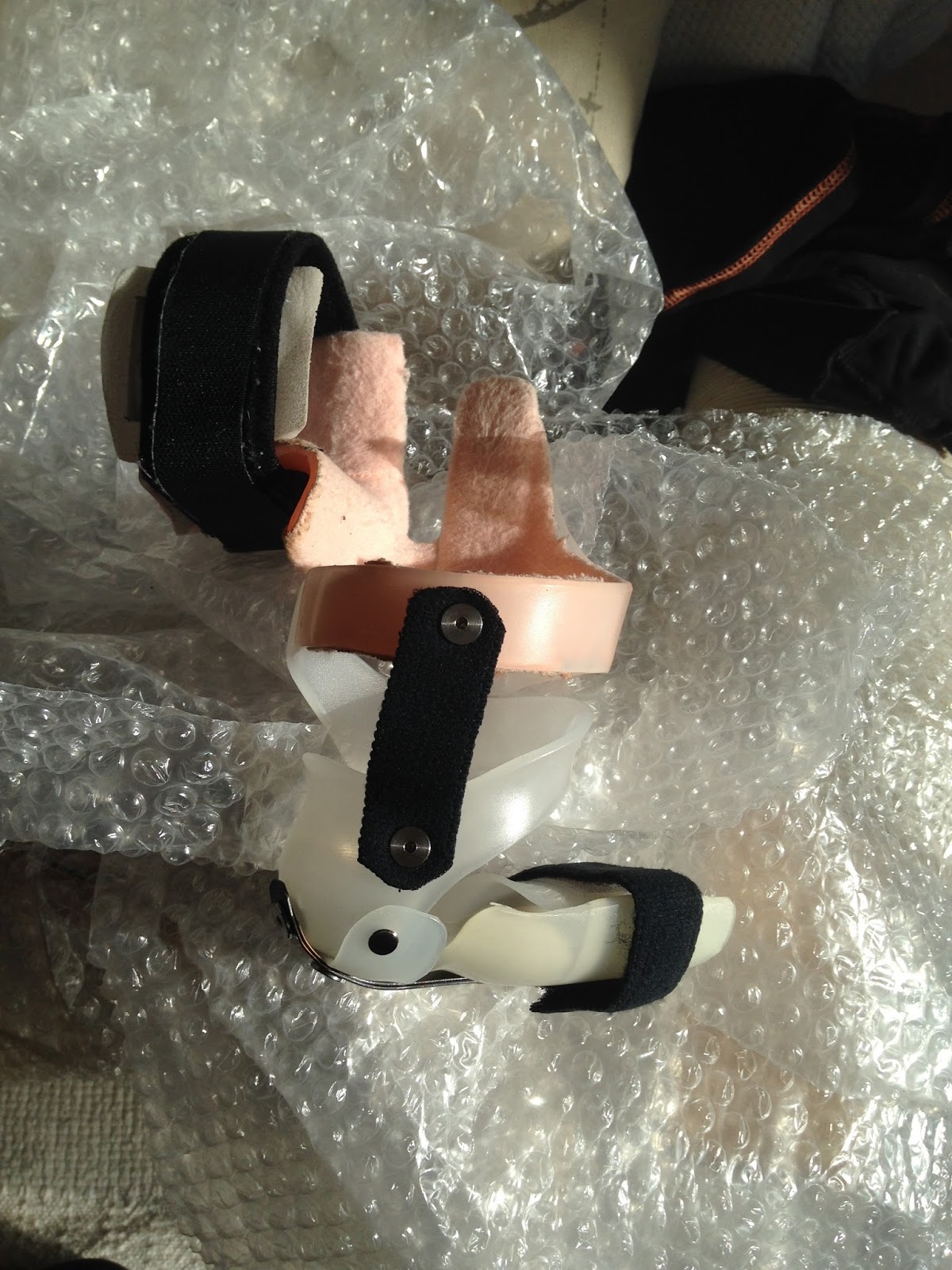 Clubfoot Brace DTKAFO Journeys February 2018