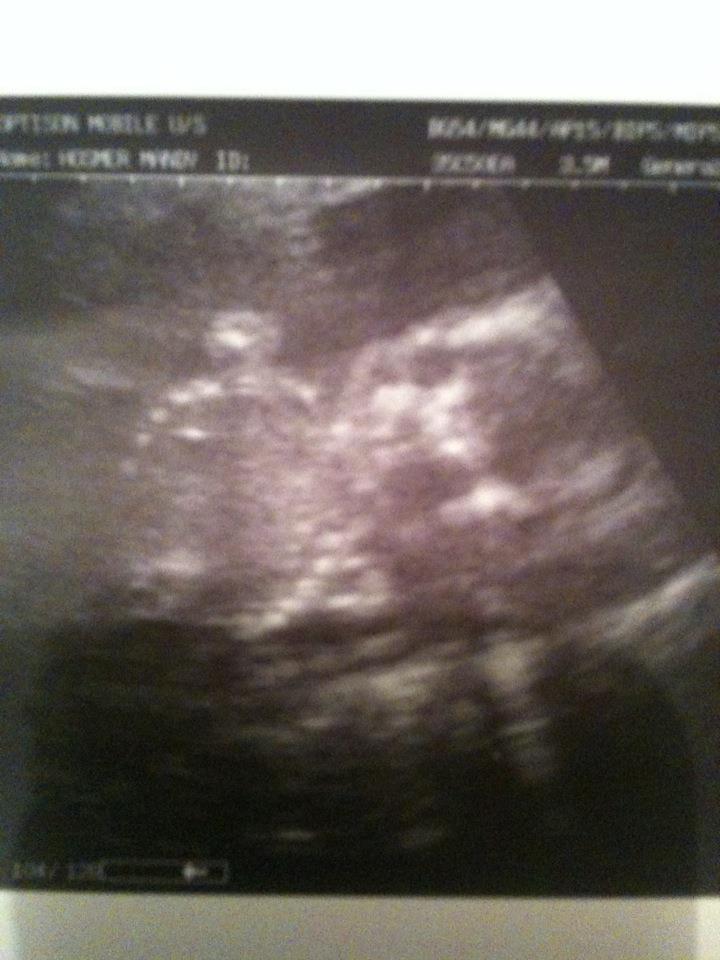 The Hosmer Family: January...so far