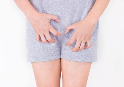 Image Penyebab gatal pada organ intim wanita