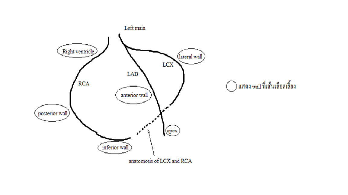 19+ ติด Ekg V3R V4R Background
