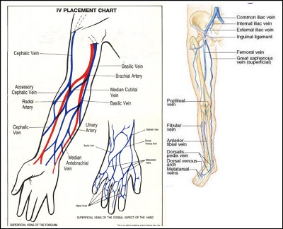 Stacy's Blog on IV insertion