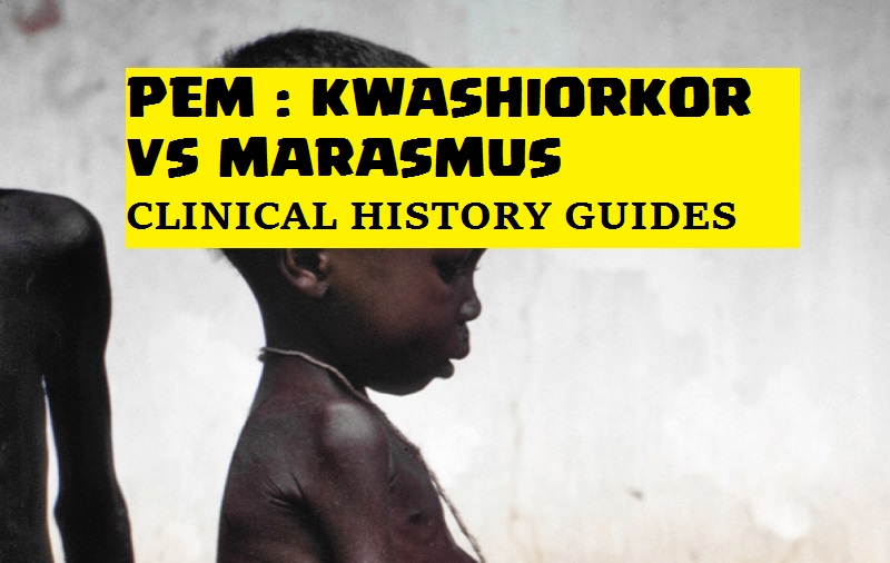 kwashiorkor vs marasmus pem