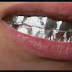 بالفيديو:ماذا يحدث عند وضع الالمنيوم على الاسنان؟