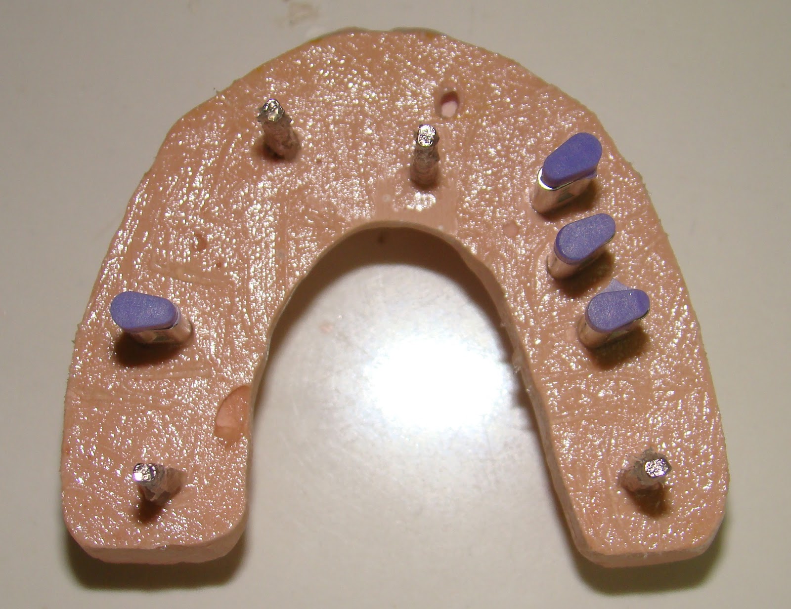 Dowel Pin Dental Para Que Sirve at Louis Gomez blog