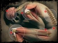 Dolor Crónico Dolor Crónico