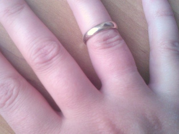 След от золотого кольца почему. След от кольца на пальце. Кольцо с отпечатком пальца. Неснимаемое кольцо на пальце.